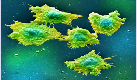 Cancer du colon: Identification d’un nouveau gène suppresseur de la tumeur