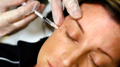 In the United States, several women became infected with HIV after undergoing blood plasma facials.